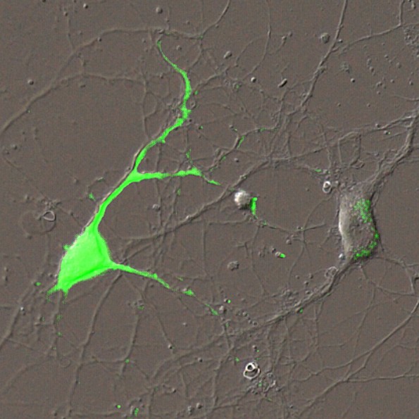 Fluoreszierende Nervenzellen