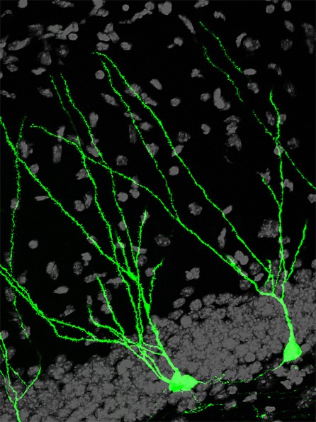 Nervenzellen im Hippocampus