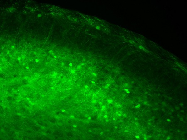 Nervenzellen im Rckenmark