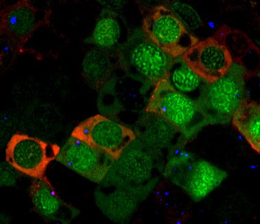 DNA-Fragmente im Zellkern