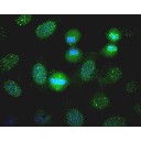 DNA-Reparatur im Zellkern